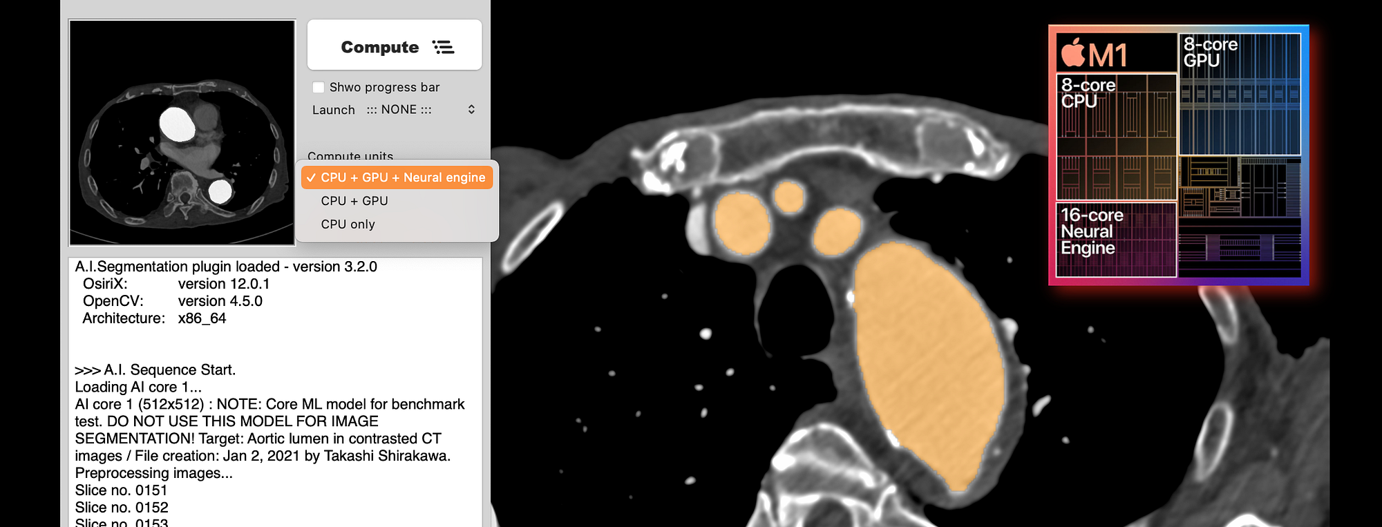 Apple Neural Engine in M1 SoC Shows Incredible Performance ...