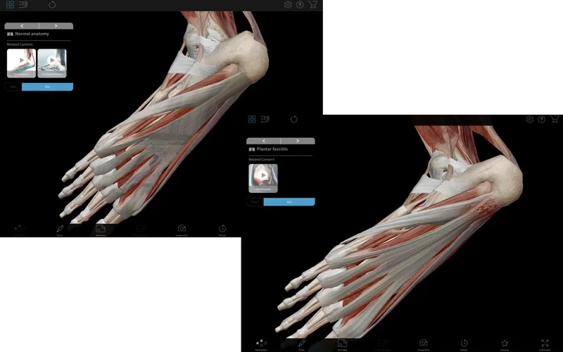 Visible Body Muscle Premium – Phần mềm giải phẫu 3D cho ngành y